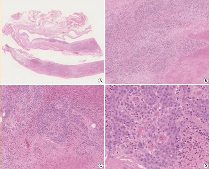 https://cdn.ncbi.nlm.nih.gov/pmc/blobs/1977/4579163/1446023517e9/aps-42-532-g002.jpg