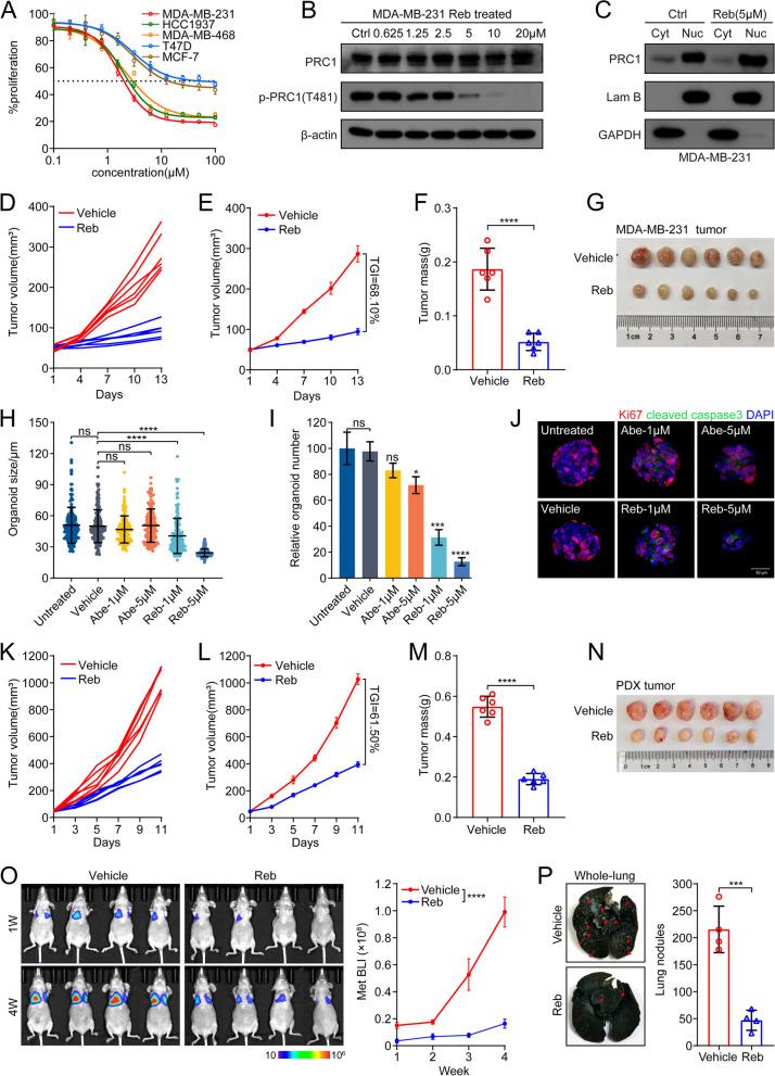 https://cdn.ncbi.nlm.nih.gov/pmc/blobs/197b/9027050/6685a46c2bd5/13046_2022_2362_Fig6_HTML.jpg
