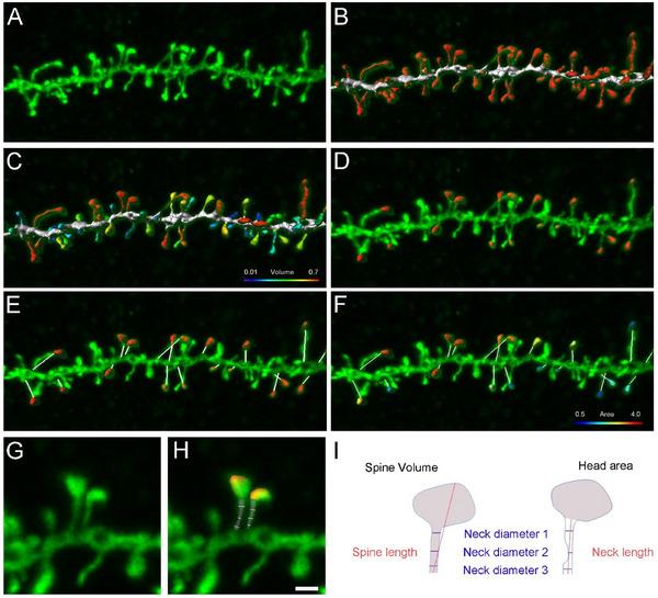 https://cdn.ncbi.nlm.nih.gov/pmc/blobs/197e/12108034/56a57cbd8f03/CNE-533-e70060-g003.jpg