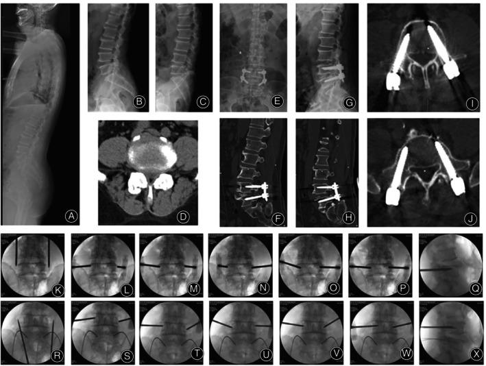 https://cdn.ncbi.nlm.nih.gov/pmc/blobs/1981/11735363/0a1c7f736599/OS-17-82-g001.jpg