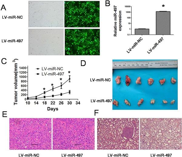 https://cdn.ncbi.nlm.nih.gov/pmc/blobs/1985/4745744/51fcb7d1d81b/oncotarget-06-29527-g009.jpg