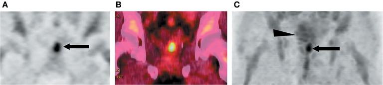 https://cdn.ncbi.nlm.nih.gov/pmc/blobs/1985/5775220/1c425337b136/fchem-05-00124-g0007.jpg