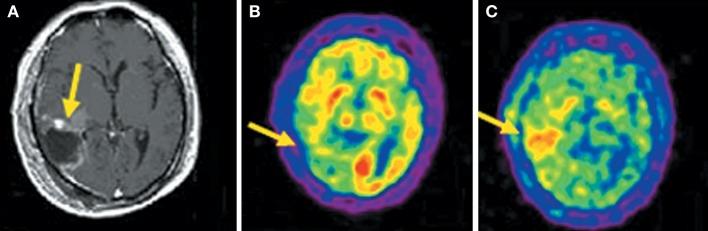 https://cdn.ncbi.nlm.nih.gov/pmc/blobs/1985/5775220/ce2388abec13/fchem-05-00124-g0003.jpg