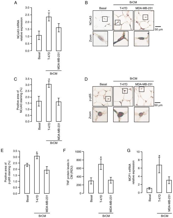 https://cdn.ncbi.nlm.nih.gov/pmc/blobs/1987/10091077/d10b5e14e796/or-49-05-08542-g02.jpg