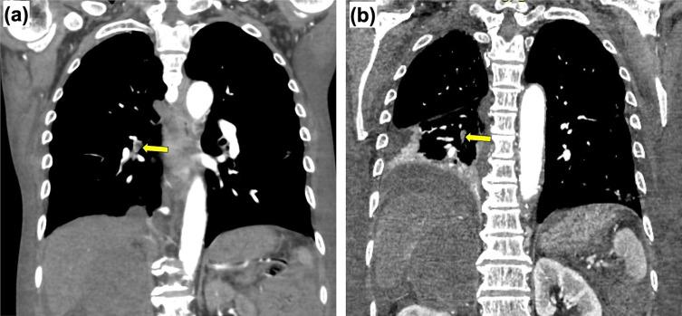 https://cdn.ncbi.nlm.nih.gov/pmc/blobs/1987/11528258/944b55082fd4/jslrt-64-242-g003.jpg