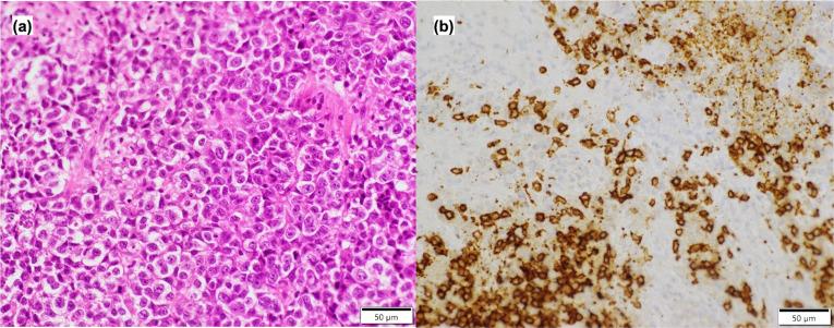 https://cdn.ncbi.nlm.nih.gov/pmc/blobs/1987/11528258/a0936983b15f/jslrt-64-242-g002.jpg