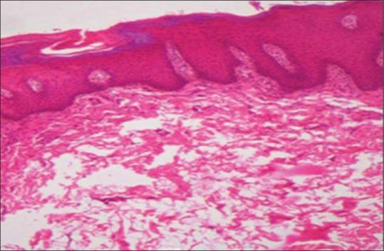 https://cdn.ncbi.nlm.nih.gov/pmc/blobs/198c/6306607/f65cd341e8a8/JOMFP-22-307-g002.jpg