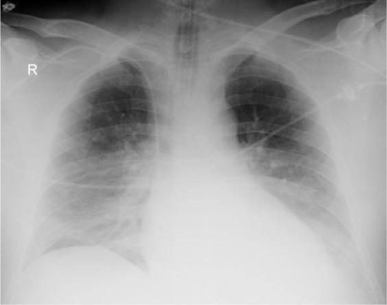 https://cdn.ncbi.nlm.nih.gov/pmc/blobs/1991/4476490/5de5b0913aff/tcrm-11-961Fig1.jpg