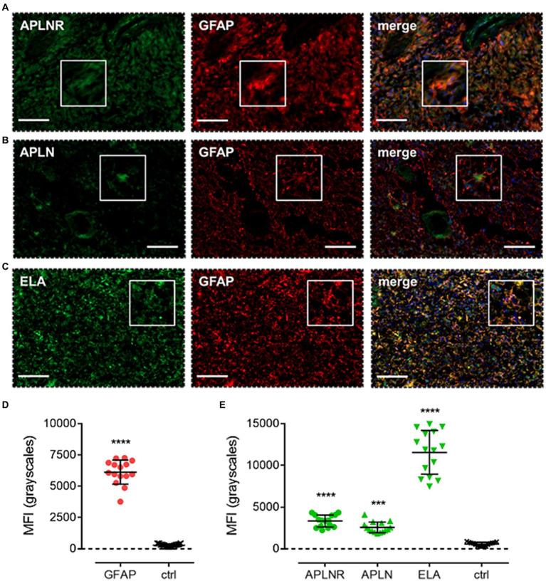 https://cdn.ncbi.nlm.nih.gov/pmc/blobs/1997/11128631/837a3e0e233b/fnins-18-1379658-g008.jpg