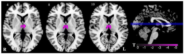 https://cdn.ncbi.nlm.nih.gov/pmc/blobs/199a/9954115/f0aa90ffef87/brainsci-13-00183-g001.jpg
