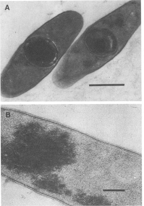 https://cdn.ncbi.nlm.nih.gov/pmc/blobs/199e/183567/6d0260ebdbf0/aem00061-0204-a.jpg
