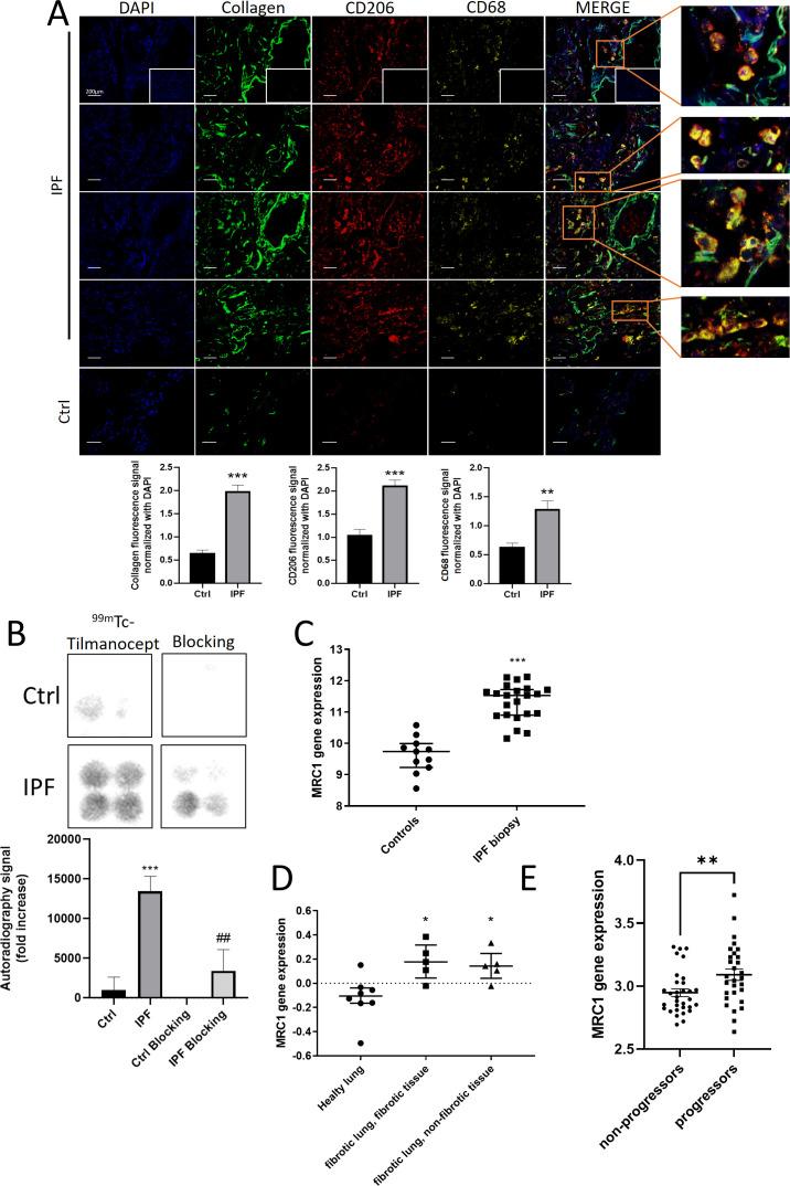 https://cdn.ncbi.nlm.nih.gov/pmc/blobs/19ab/11672011/47e669ffb3b2/thorax-79-12-g002.jpg