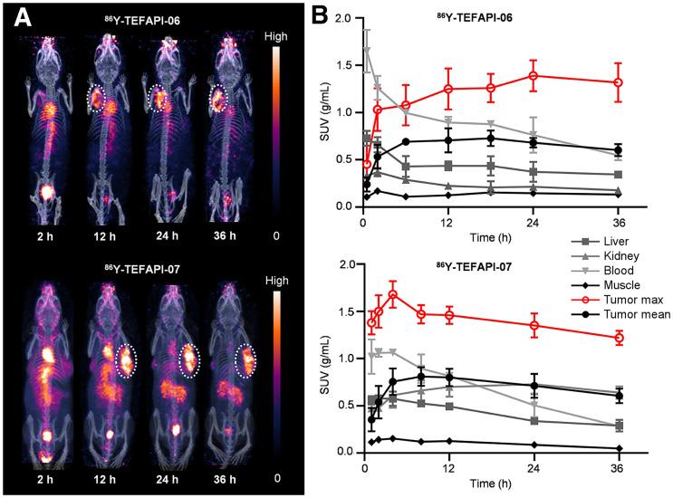 https://cdn.ncbi.nlm.nih.gov/pmc/blobs/19b7/9157728/c50340684282/jnumed.121.262533f3.jpg