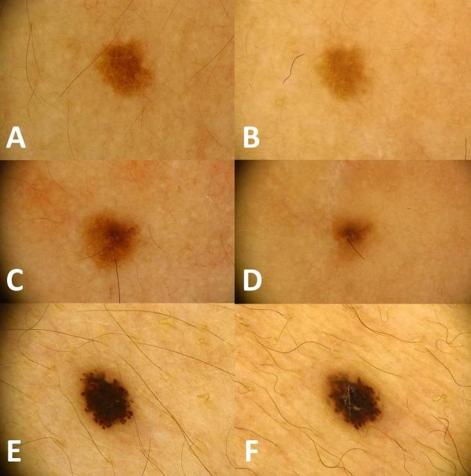 https://cdn.ncbi.nlm.nih.gov/pmc/blobs/19b9/5955082/b1b4b7368635/dp0802a13g001.jpg