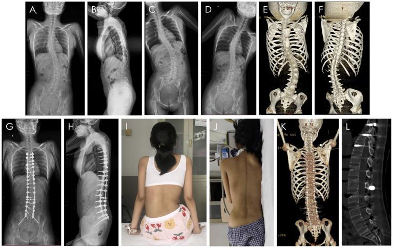 https://cdn.ncbi.nlm.nih.gov/pmc/blobs/19b9/9082934/74c700ad9de2/fneur-13-869230-g0001.jpg