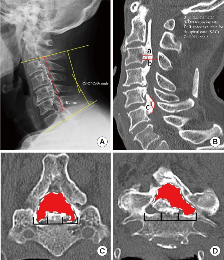 https://cdn.ncbi.nlm.nih.gov/pmc/blobs/19bc/10323351/e5c183d057b4/ns-2346124-062f1.jpg