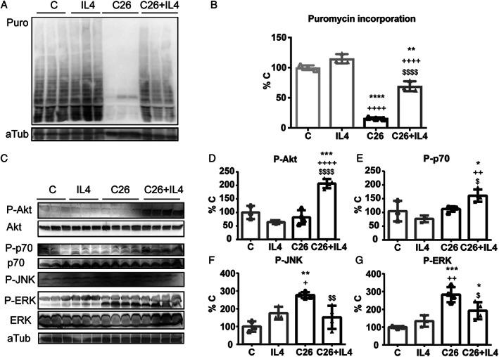 https://cdn.ncbi.nlm.nih.gov/pmc/blobs/19bc/7296260/3b7023d45d28/JCSM-11-783-g004.jpg