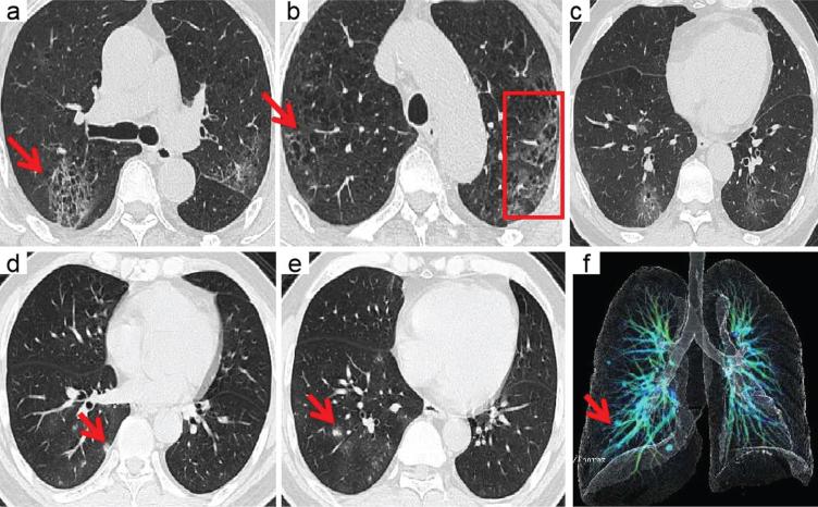 https://cdn.ncbi.nlm.nih.gov/pmc/blobs/19bc/7592672/c197c0b8d3ef/xst-28-xst200709-g005.jpg