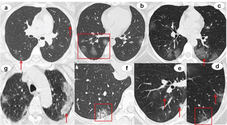 https://cdn.ncbi.nlm.nih.gov/pmc/blobs/19bc/7592672/dbfbf2aa032f/xst-28-xst200709-g003.jpg