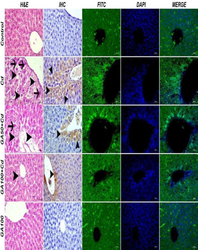 https://cdn.ncbi.nlm.nih.gov/pmc/blobs/19bf/10598816/24ac0bf1b5dd/IJBMS-26-1326-g005.jpg