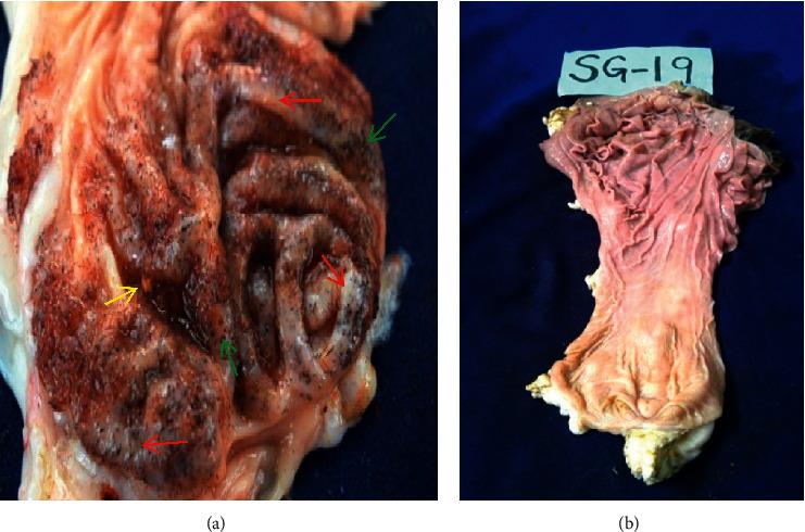 https://cdn.ncbi.nlm.nih.gov/pmc/blobs/19bf/7875620/5d88ea3fa074/VMI2021-8831996.009.jpg