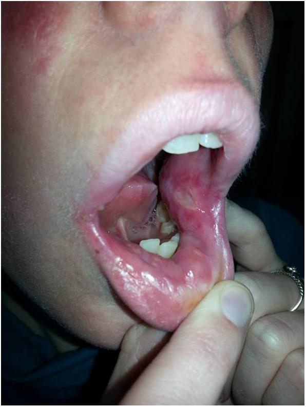 https://cdn.ncbi.nlm.nih.gov/pmc/blobs/19c3/7270203/904417ef95a4/fimmu-11-00967-g0001.jpg