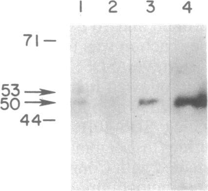 https://cdn.ncbi.nlm.nih.gov/pmc/blobs/19ca/55086/5bb9ecd56c41/pnas01047-0315-a.jpg