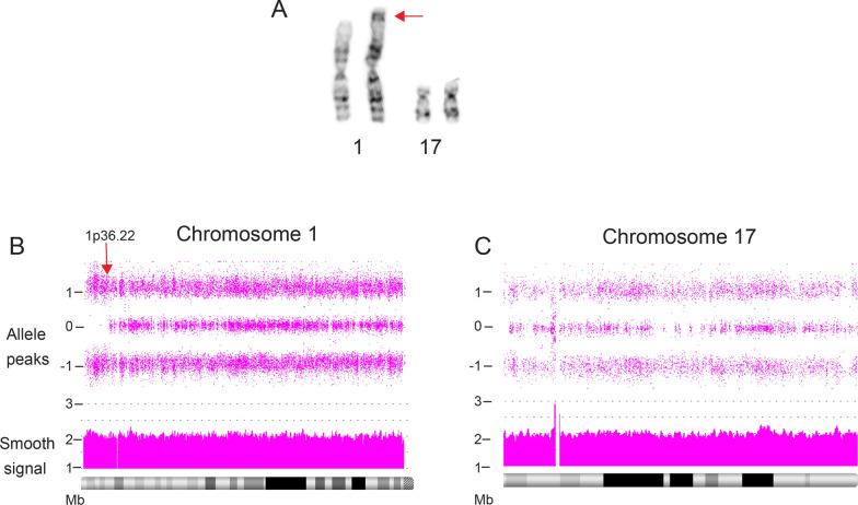 https://cdn.ncbi.nlm.nih.gov/pmc/blobs/19d1/8290618/7e12e951f0f7/13039_2021_555_Fig5_HTML.jpg