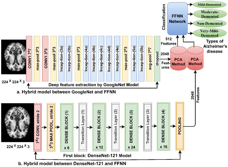 https://cdn.ncbi.nlm.nih.gov/pmc/blobs/19d4/10178535/7fed2fbdc123/diagnostics-13-01654-g004.jpg