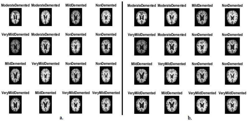 https://cdn.ncbi.nlm.nih.gov/pmc/blobs/19d4/10178535/d57d5b890d34/diagnostics-13-01654-g002.jpg
