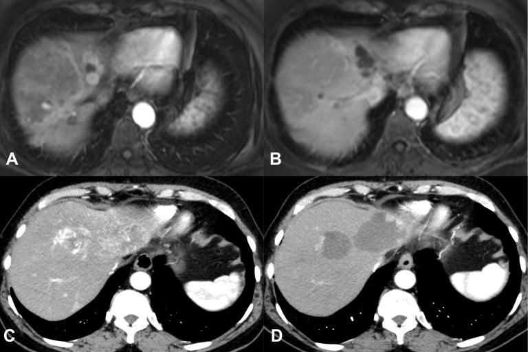 https://cdn.ncbi.nlm.nih.gov/pmc/blobs/19d7/8128497/98029f39eaeb/JHC-8-403-g0004.jpg