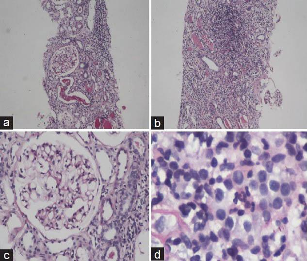 https://cdn.ncbi.nlm.nih.gov/pmc/blobs/19df/3987198/0e10282e4643/IJPharm-46-230-g001.jpg
