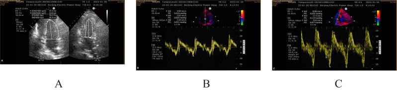 https://cdn.ncbi.nlm.nih.gov/pmc/blobs/19e3/10200692/4a237cf9782f/RMHP-16-921-g0001.jpg