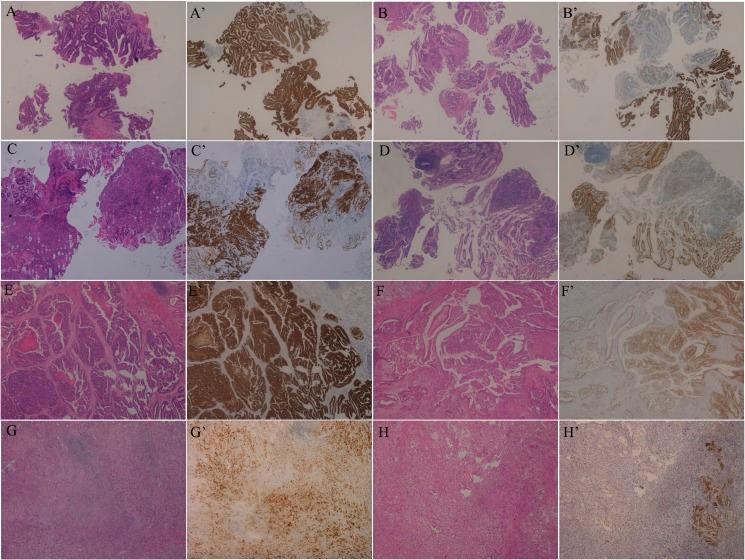 https://cdn.ncbi.nlm.nih.gov/pmc/blobs/19ed/5464860/dd2e7247faea/oncotarget-08-33185-g002.jpg