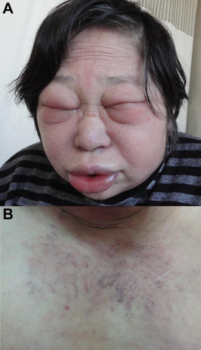 https://cdn.ncbi.nlm.nih.gov/pmc/blobs/19f8/5911095/91d5d3b0ceed/bcr-2018-224206f01.jpg
