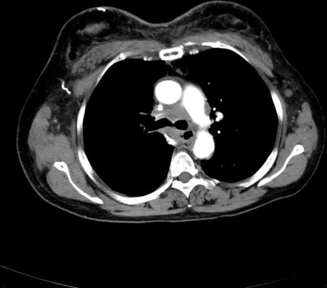 https://cdn.ncbi.nlm.nih.gov/pmc/blobs/19f8/5911095/cb9a28bac193/bcr-2018-224206f03.jpg