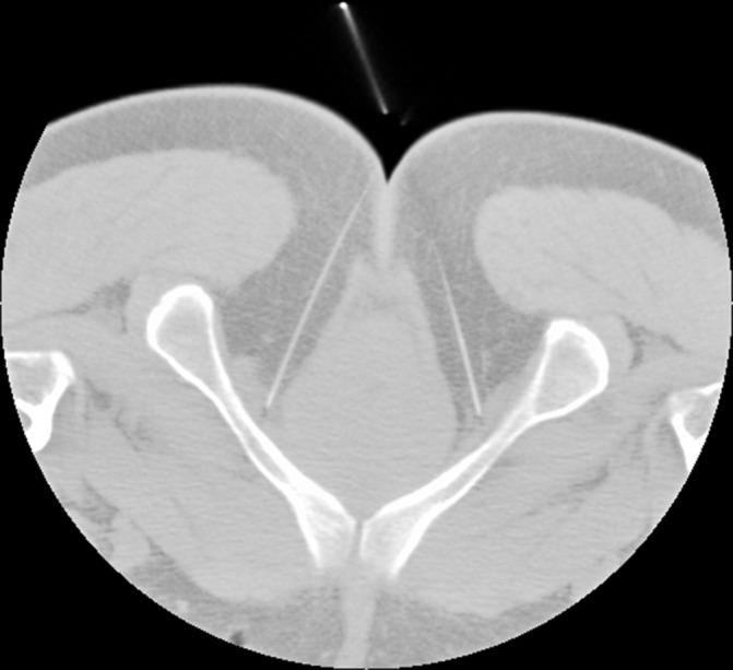 https://cdn.ncbi.nlm.nih.gov/pmc/blobs/19f9/6231555/08268fcad531/bmjopen-2018-021783f04.jpg