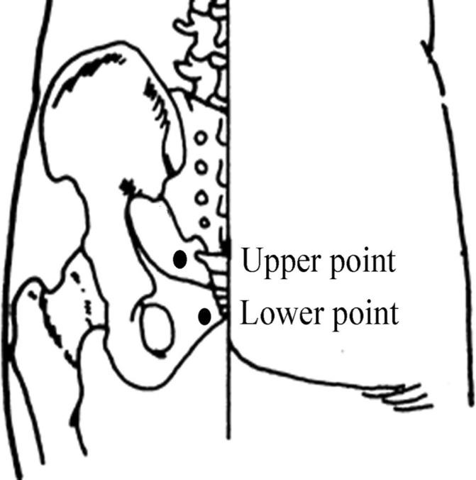 https://cdn.ncbi.nlm.nih.gov/pmc/blobs/19f9/6231555/adae1adda6f4/bmjopen-2018-021783f02.jpg