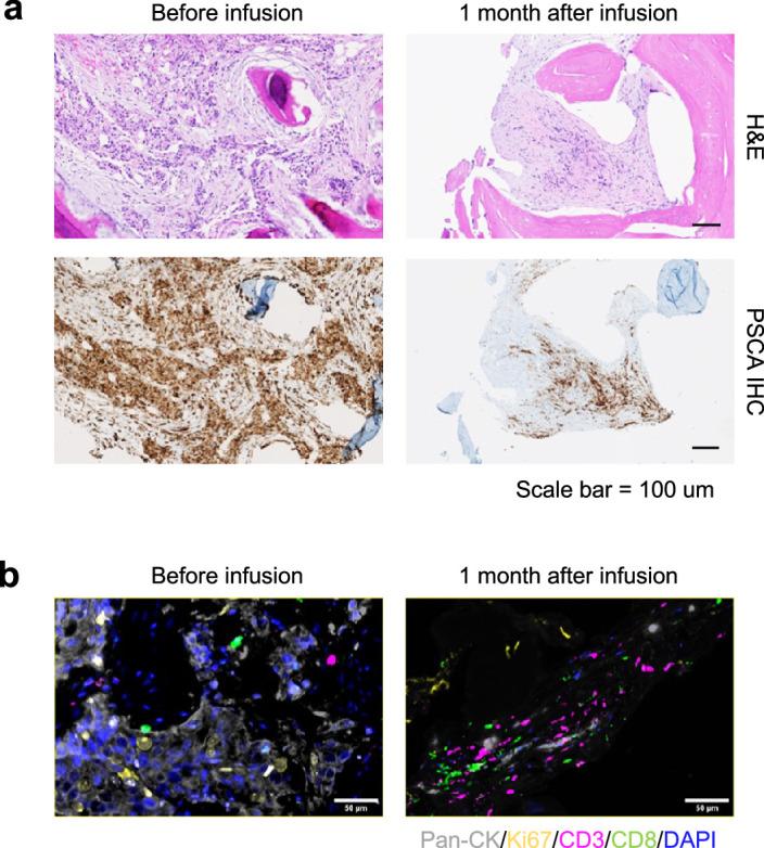 https://cdn.ncbi.nlm.nih.gov/pmc/blobs/19fc/11186768/9003ef1ef552/41591_2024_2979_Fig8_ESM.jpg