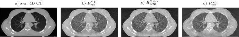https://cdn.ncbi.nlm.nih.gov/pmc/blobs/19fc/11458955/7a1025a78a04/gr5.jpg