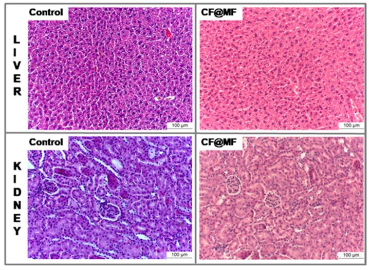 https://cdn.ncbi.nlm.nih.gov/pmc/blobs/19fc/7279505/1058336355c3/nanomaterials-10-00907-g009.jpg