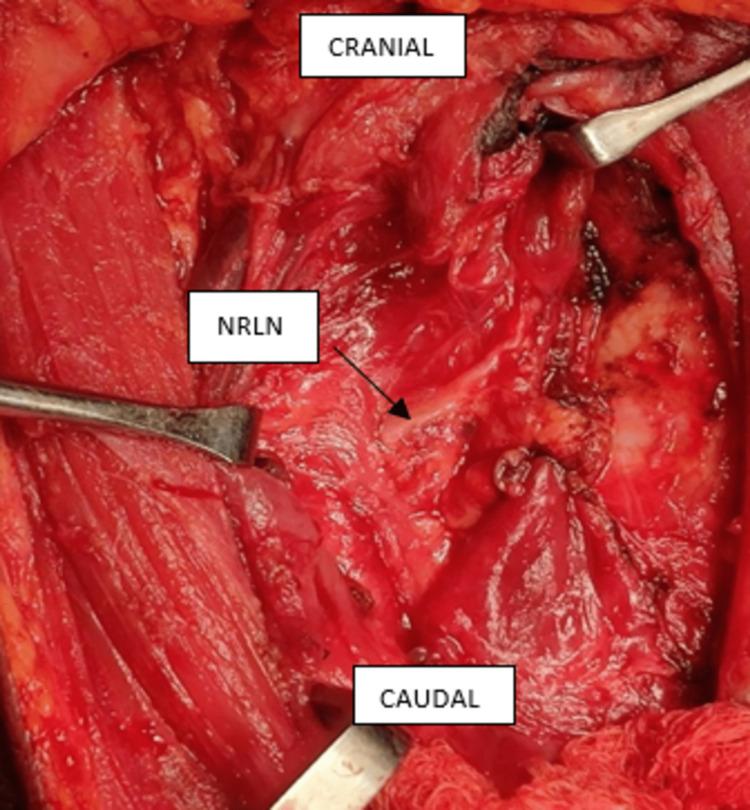 https://cdn.ncbi.nlm.nih.gov/pmc/blobs/19fc/9634855/89575c11877c/cureus-0014-00000029935-i02.jpg
