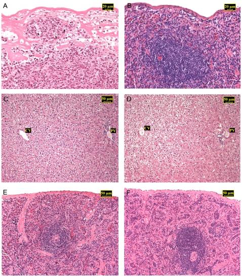 https://cdn.ncbi.nlm.nih.gov/pmc/blobs/1a01/2814861/de74ebc3ae6f/pntd.0000589.g005.jpg