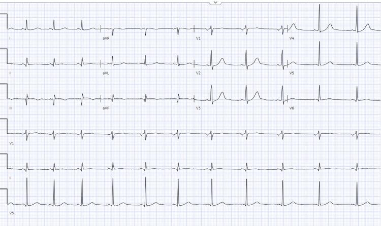 https://cdn.ncbi.nlm.nih.gov/pmc/blobs/1a05/11325169/71d8f4b3d80b/cureus-0016-00000064627-i02.jpg