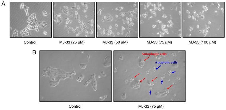 https://cdn.ncbi.nlm.nih.gov/pmc/blobs/1a0b/7757098/091c7c03c0c1/OR-45-02-0680-g01.jpg