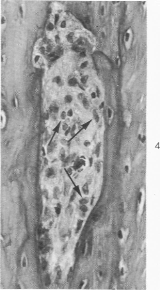 https://cdn.ncbi.nlm.nih.gov/pmc/blobs/1a0f/1910842/4079d9c67fff/amjpathol00476-0132-d.jpg