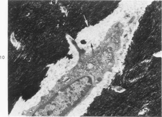 https://cdn.ncbi.nlm.nih.gov/pmc/blobs/1a0f/1910842/497b2869f845/amjpathol00476-0135-b.jpg