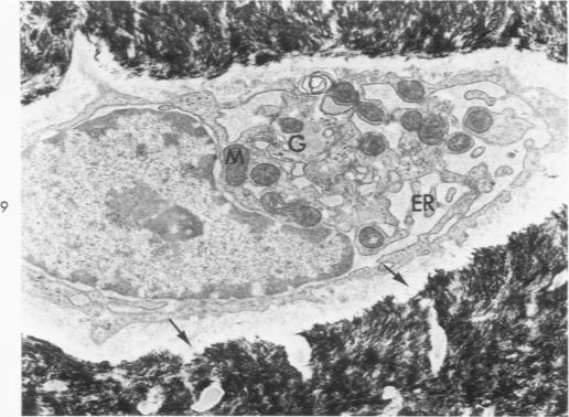 https://cdn.ncbi.nlm.nih.gov/pmc/blobs/1a0f/1910842/a0a8d082b50e/amjpathol00476-0135-a.jpg