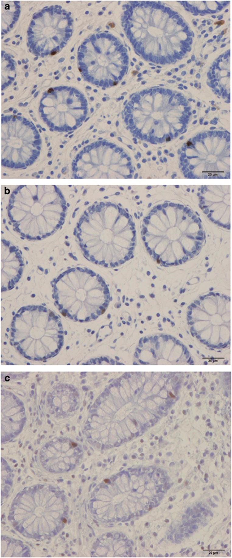 https://cdn.ncbi.nlm.nih.gov/pmc/blobs/1a19/4744244/ef6b88b36e29/ejcn2015191f2.jpg