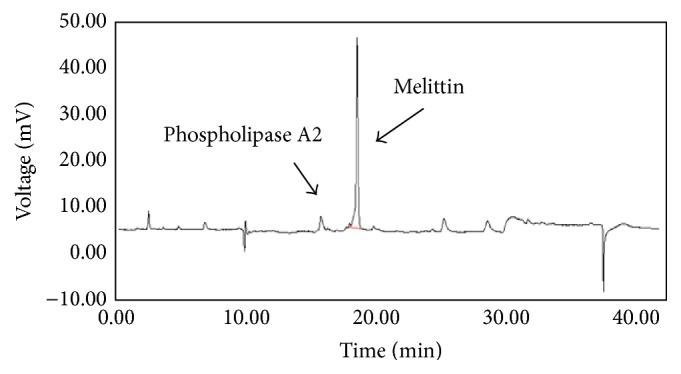 https://cdn.ncbi.nlm.nih.gov/pmc/blobs/1a1c/4987476/6f4d1eab572a/ECAM2016-3704764.001.jpg